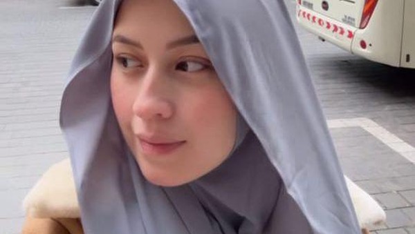 Kimberly Akui Berusaha Terima Kenyataan dengan Lapang Dada